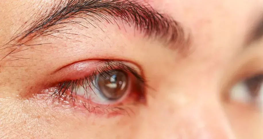 Psoridin Azərbaycan - qiymət - rəylər - bu nədir - harada almaq - nəticə - aptek - sifariş.